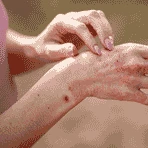 Generic Clarinex Tablet